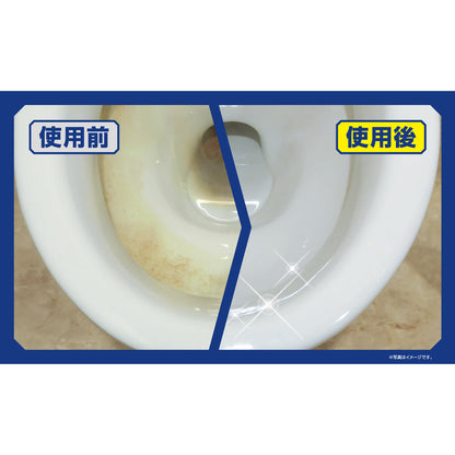 Aion (Haruko Niitsu) Toilet Stain and Urine Scale Cleaner Gel Type