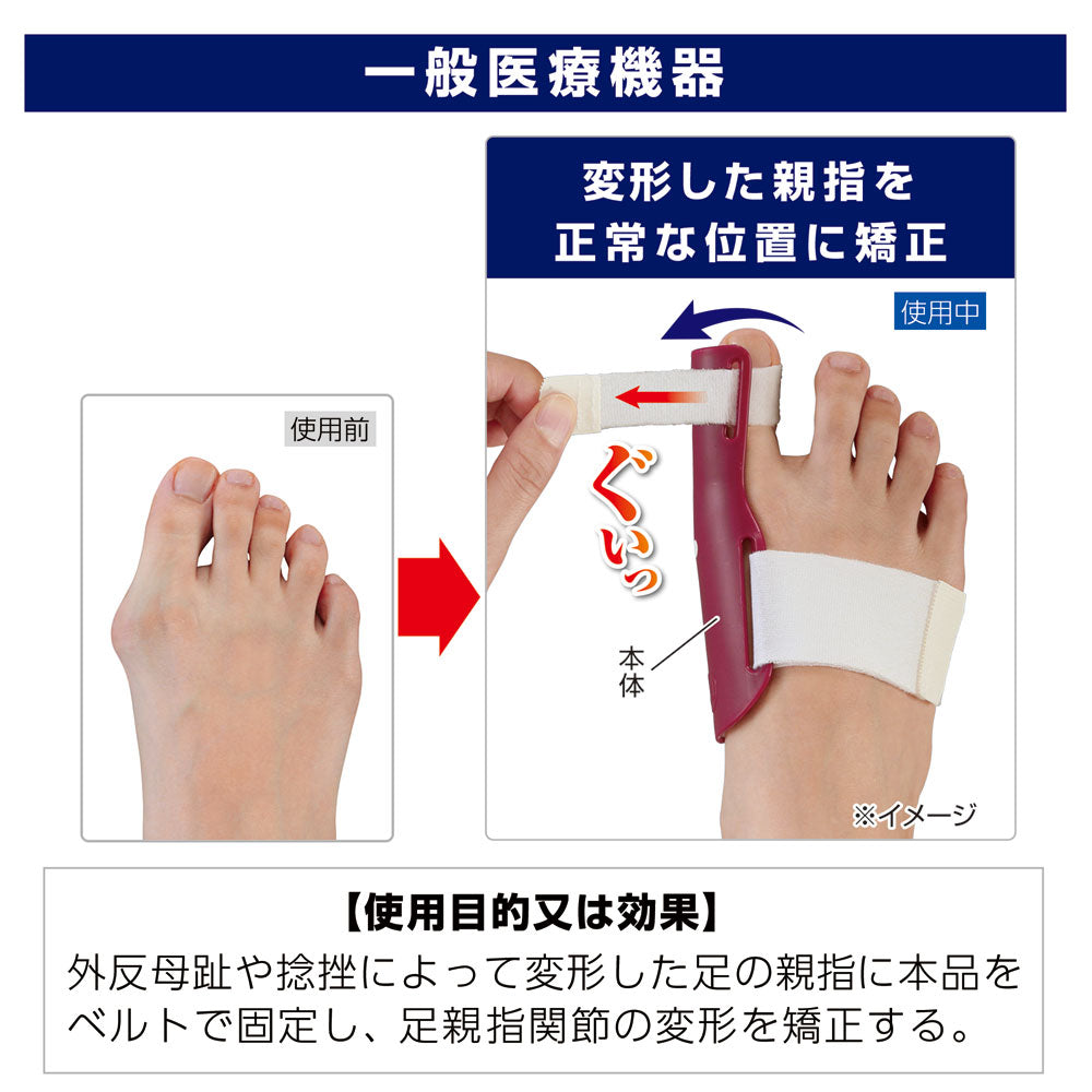 【General Medical Device】Cyplus Plus Walk Hallux Valgus Correction Protector Right Foot 1 Piece