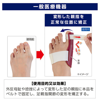 Cyplus Plus Walk Hallux Valgus Correction Protector Left Foot 1 Piece