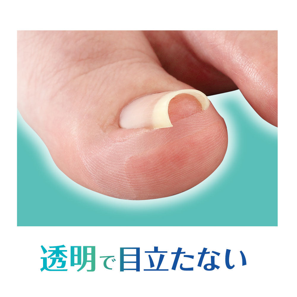 Cyplus Transparent Ingrown Toenail Tape Miene 10 Sheets