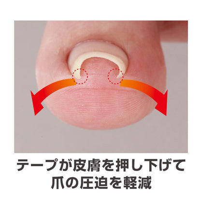 Cyplus Transparent Ingrown Toenail Tape Miene 10 Sheets