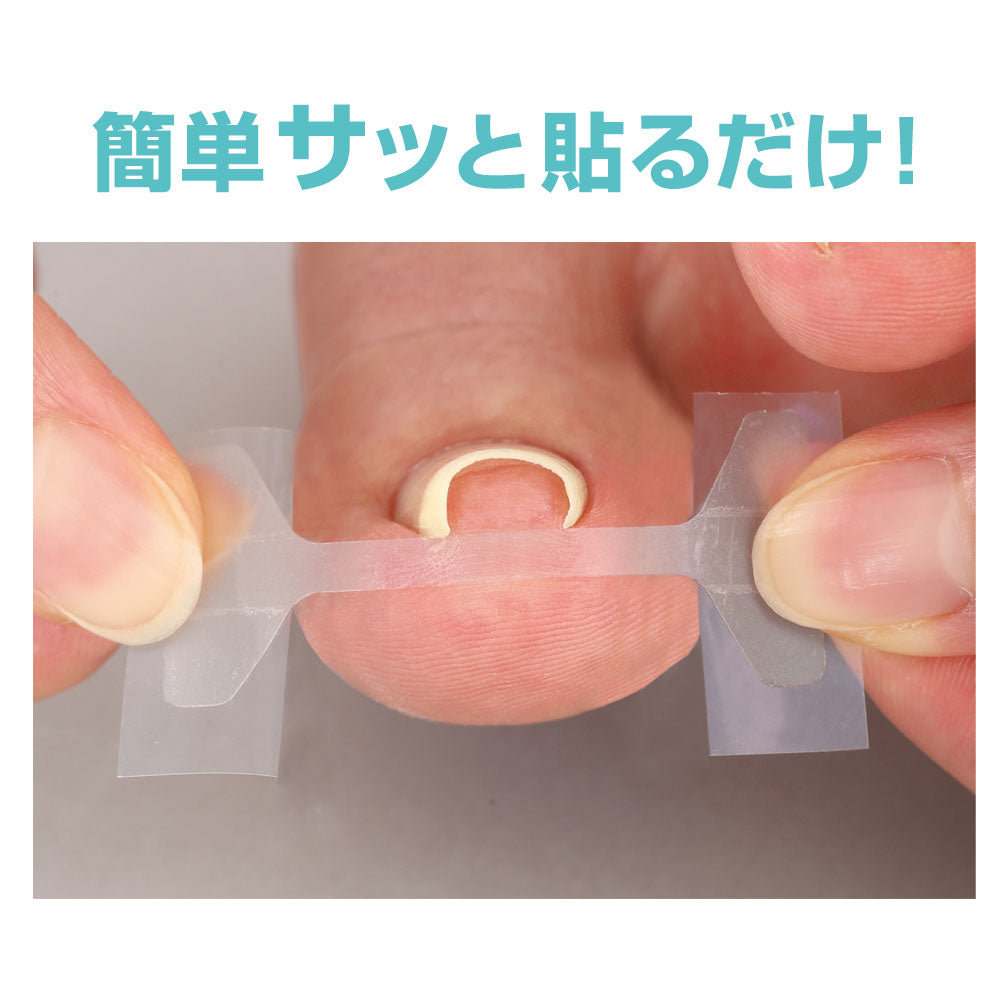 Cyplus Transparent Ingrown Toenail Tape Miene 10 Sheets