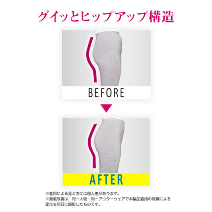 MediQttO Pelvic Support Hip-Up Girdle L Size