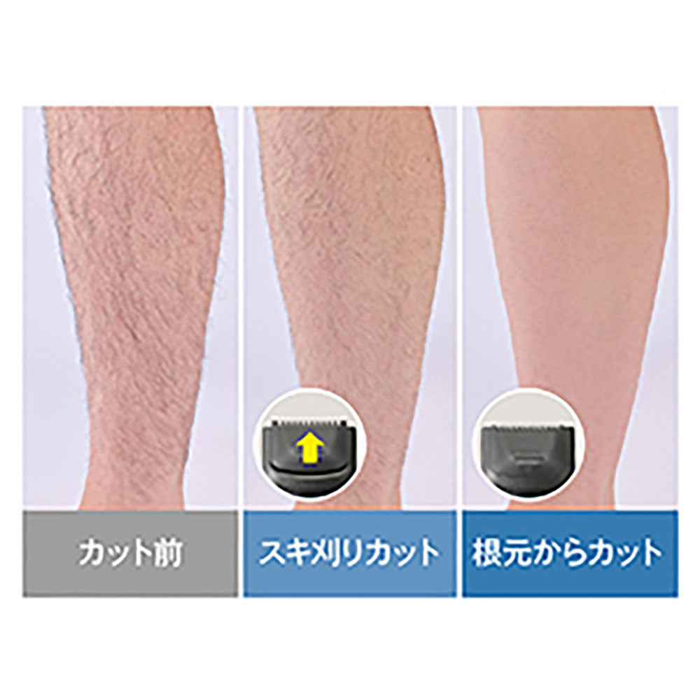 Leg Hair Trimmer KMC0631H
