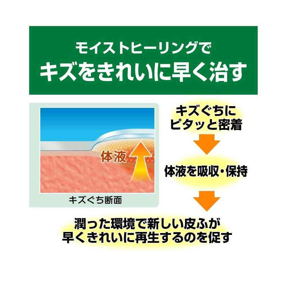 [Managed Medical Device] Nichiban Care Leave Healing Power CN5B Big (5 Pieces)