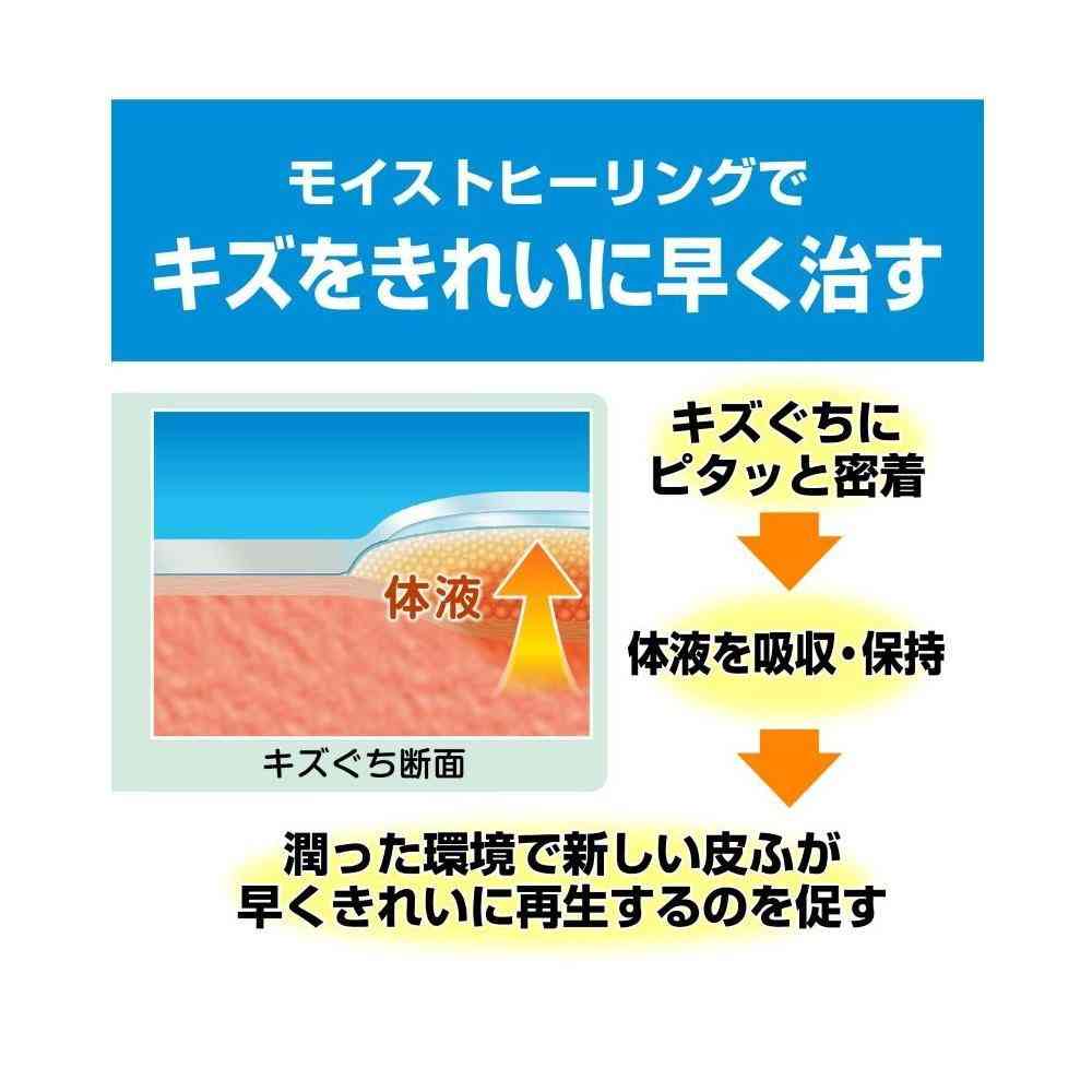Nichiban Care Leave Healing Power Waterproof Type CNB12M M Size, 12 Count
