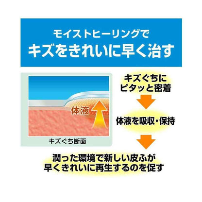 Nichiban Care Leave Healing Power Waterproof Type CNB12M M Size, 12 Count