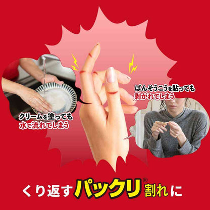 [Medical Device] Ikeda Mohando Hibi Care Pad Band-Aid (10 Pieces)